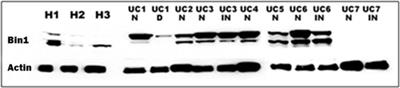 Gut-brain connections in neurodegenerative disease: immunotherapeutic targeting of Bin1 in inflammatory bowel disease and Alzheimer’s disease